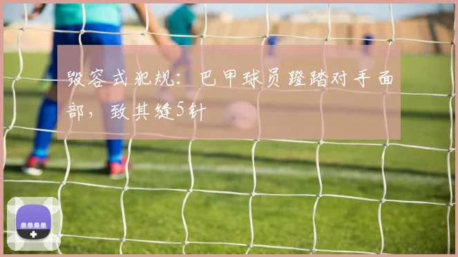 毁容式犯规：巴甲球员蹬踏对手面部，致其缝5针